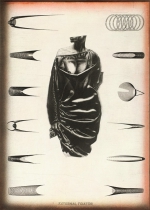 external fixator IVc internet.jpg